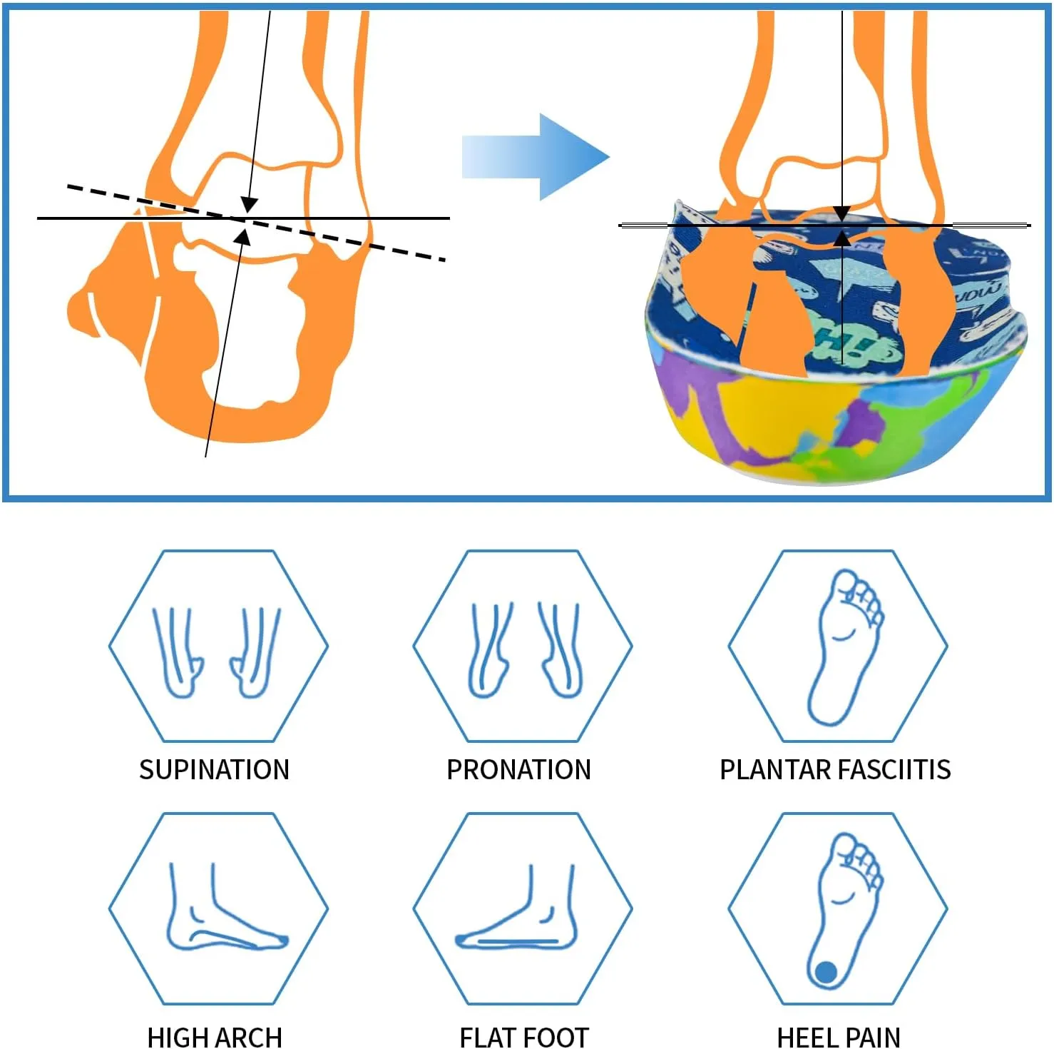 Kids Arch Support Orthotics Plantar Fasciitis Flat Feet Over-Pronation Insoles Relieve Arch, Heel & Ankle Foot Pain Inserts with Heel Cushion (7-7.5M Toddler, Multicolor)